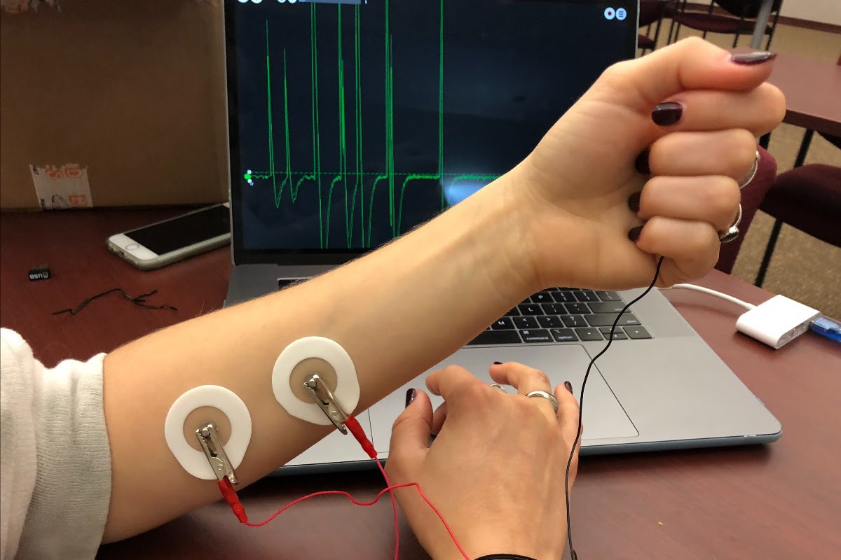 UCI Virtual Brain Camp - Image of person with electrodes on arm