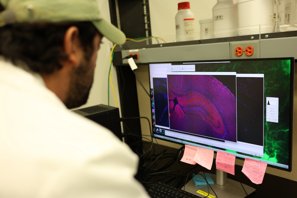 Matthew Sandoval observes an image similar to the one that appeared on the cover of the journal. To create these images, scientists first cut the brain into ultra-thin slices. They apply glowing molecular tags that bind to a protein of interest (MDGA1) and to cell nuclei. Under a fluorescence microscope, each tag lights up in a different color. A specialized camera records the signals, producing a color-coded image that shows where the protein is found across brain regions.
Photo credit: Thien Pham